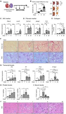 Macrophages promote Fibrinogenesis during kidney injury